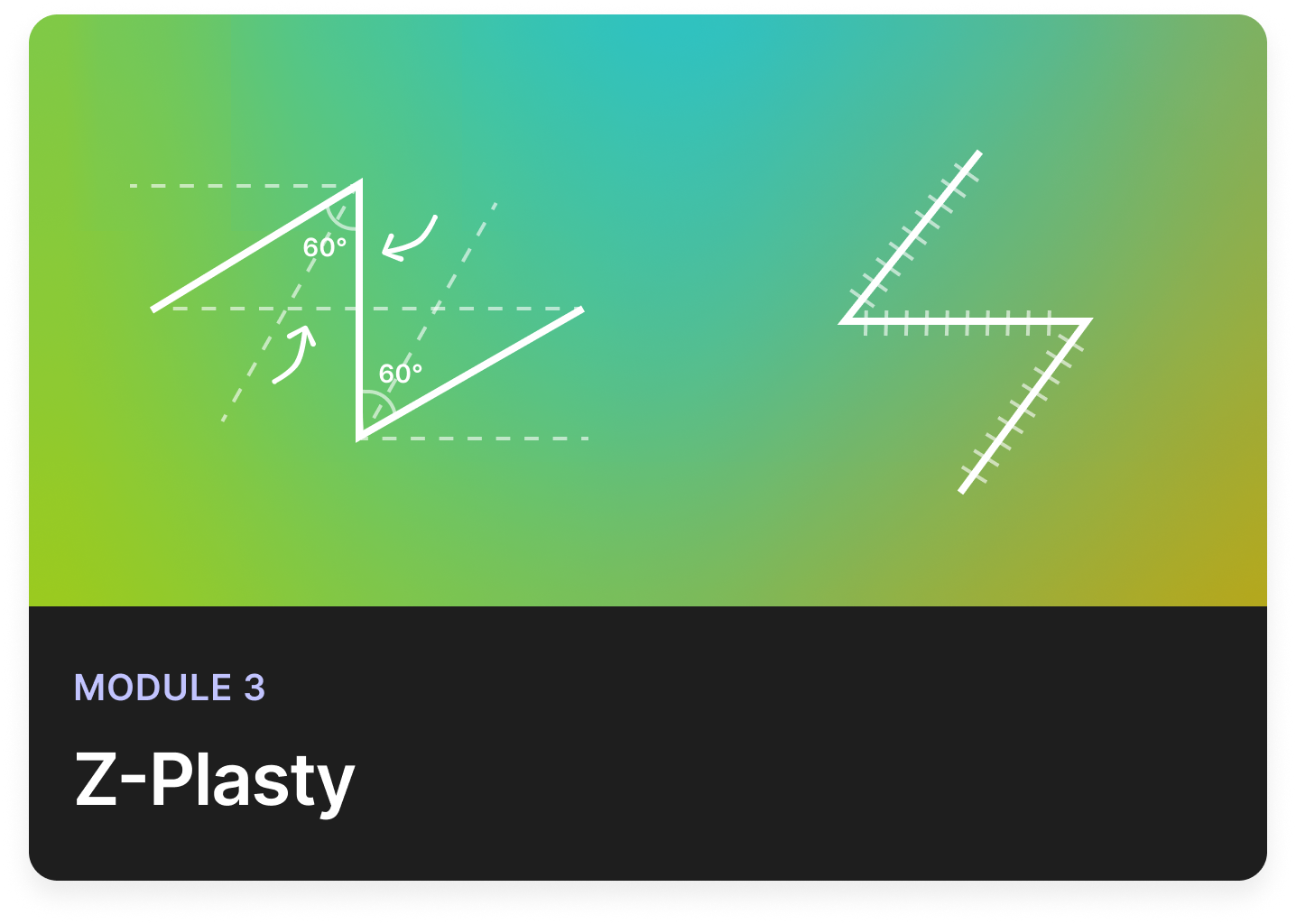 Zplasty