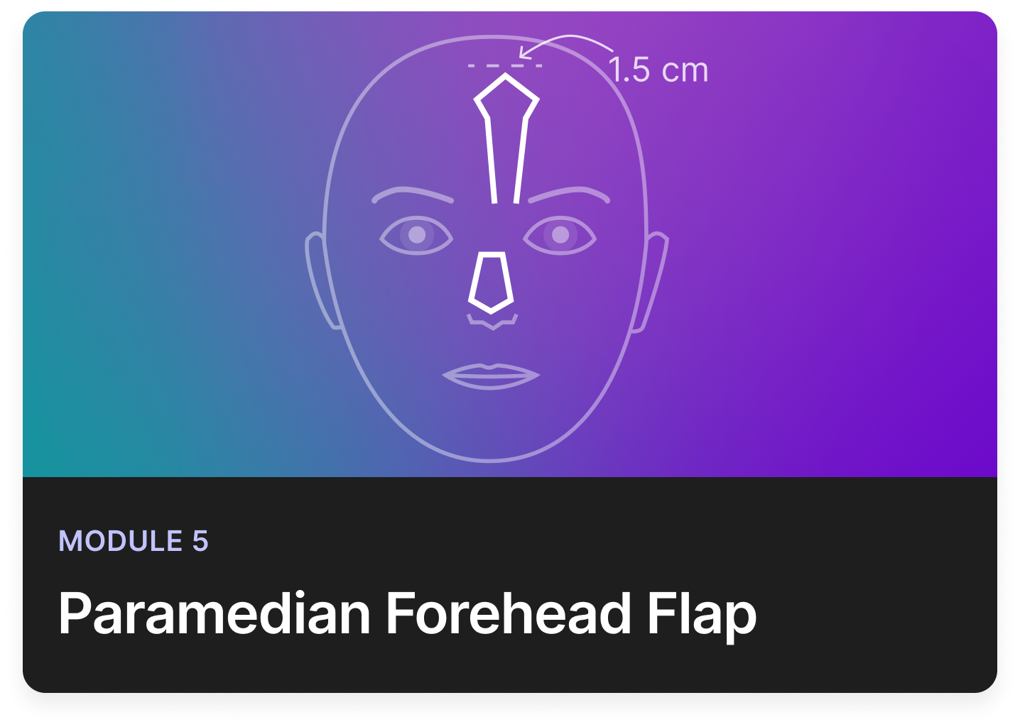 Paramedian forehead flap